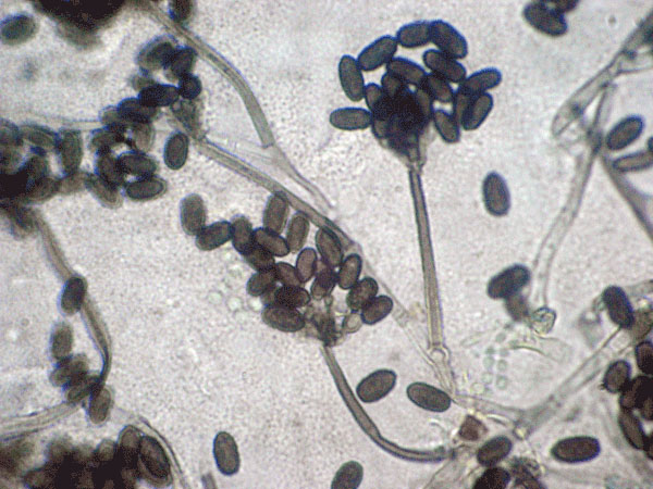 Black mold under the microscope